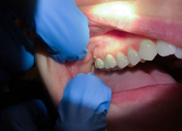 Best Orthodontic Emergency Dentist in Trenton, MI