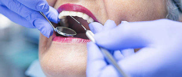 Best Emergency Dental Extractions in Trenton, MI